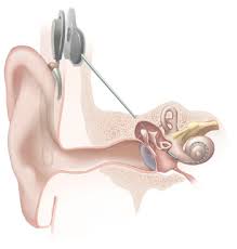 Health effects of noise. Ill health